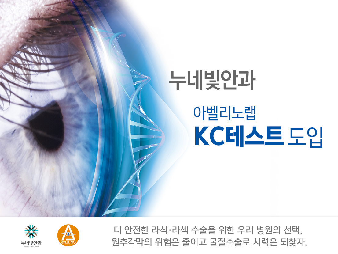 누네빛안과 원추각막 KC 테스트 도입 썸네일 이미지