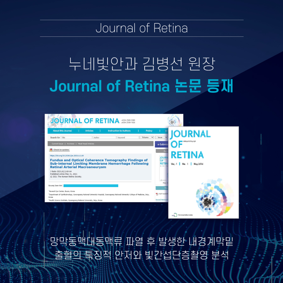 김병선 원장 집필 논문, 6월 Journal of Retina 등재 썸네일 이미지