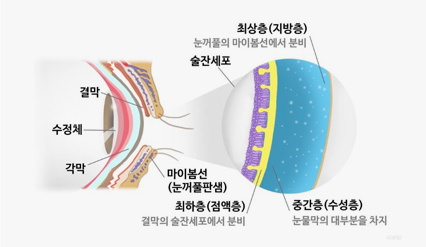 비트라레이저